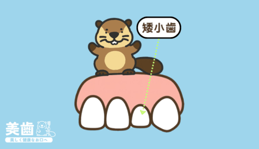 歯が小さい人は矮小歯！原因や治療法を紹介